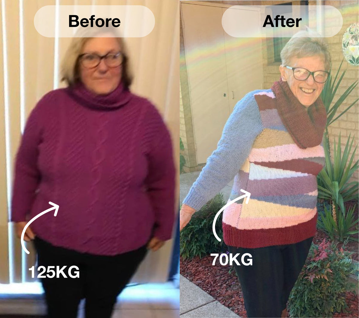 Margaret before and after, lost 55 kg